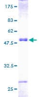 Human PTHLH / PTHRP Protein (Recombinant GST)