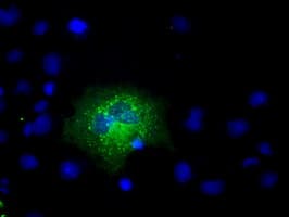 APP / Beta Amyloid Precursor Antibody (clone OTI3D11)