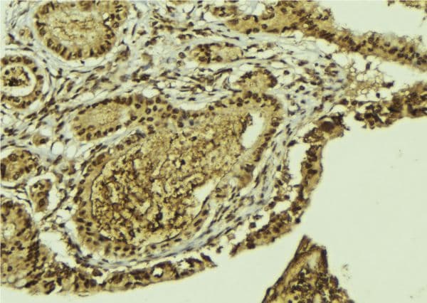 Polyclonal Rabbit anti-Human ATF2 Antibody (IHC, IF, WB)