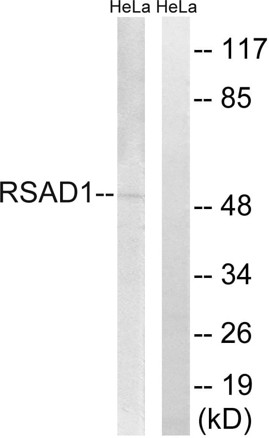 Polyclonal Rabbit anti-Human RSAD1 Antibody (aa298-347, IHC, WB)