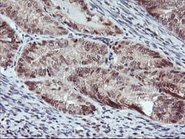 RFXANK Antibody (clone OTI2F12)