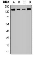 IHC-plus™ HDAC6 Antibody (N-Terminus)