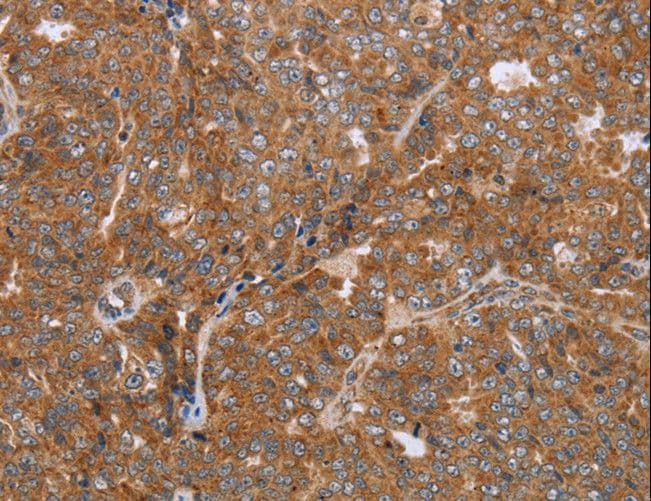 NDUFS2 Antibody