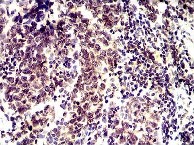Monoclonal Mouse anti-Human ID2 Antibody (clone 4E12G5, Amino Acid: 1-134, IHC, WB)