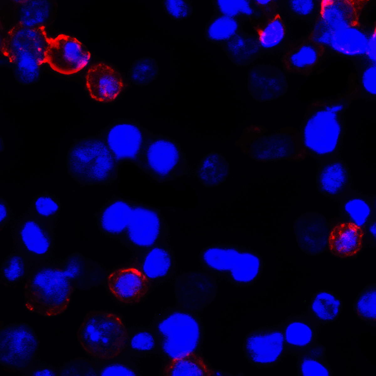 CD274 / B7-H1 / PD-L1 Antibody (clone 6H10)