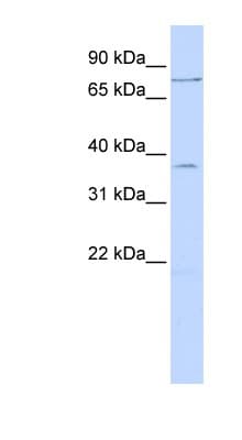 ZNF264 Antibody (N-Terminus)