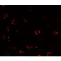 TESPA1 / KIAA0748 Antibody