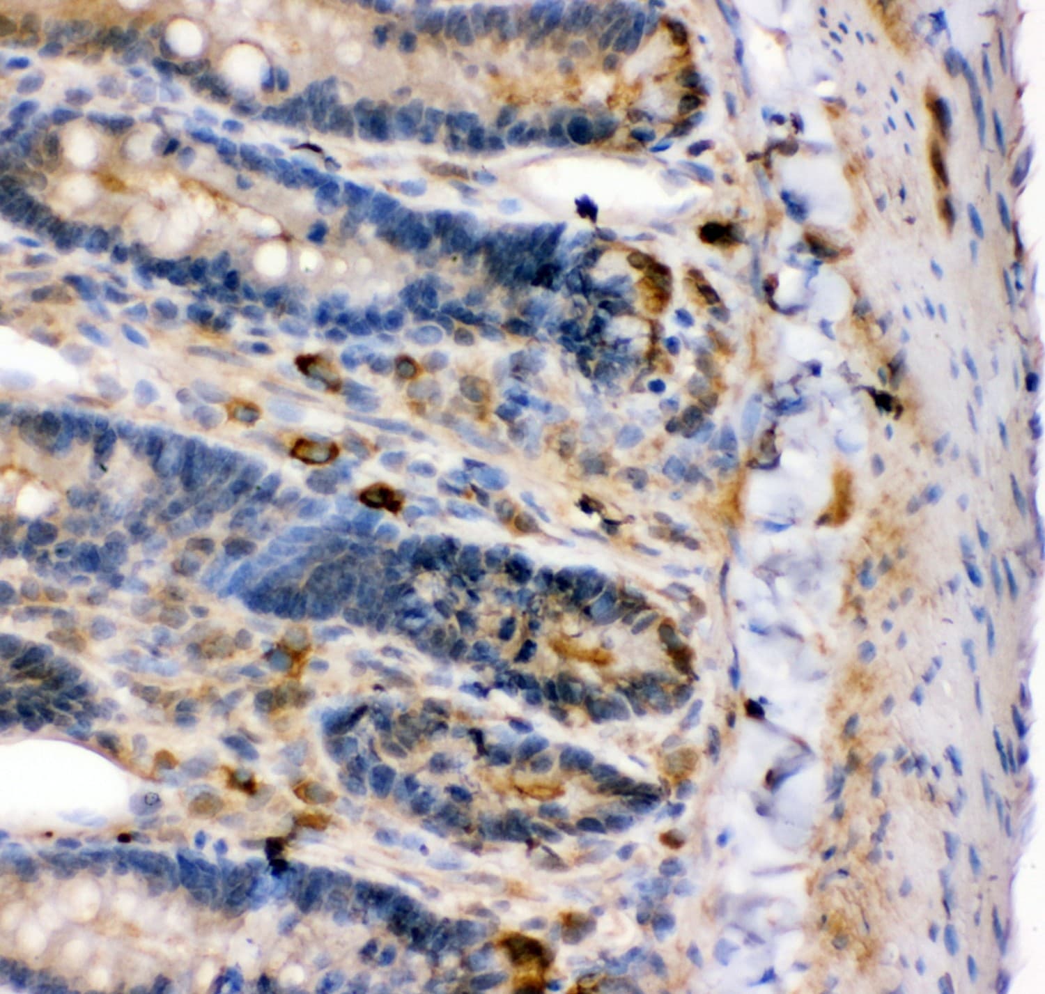KCNMA1 / BK Antibody (aa124-467)