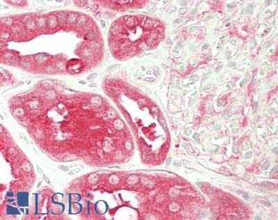 IHC-plus™ Polyclonal Rabbit anti-Human PDSS2 / DLP1 Antibody (aa88-351, IHC, WB)