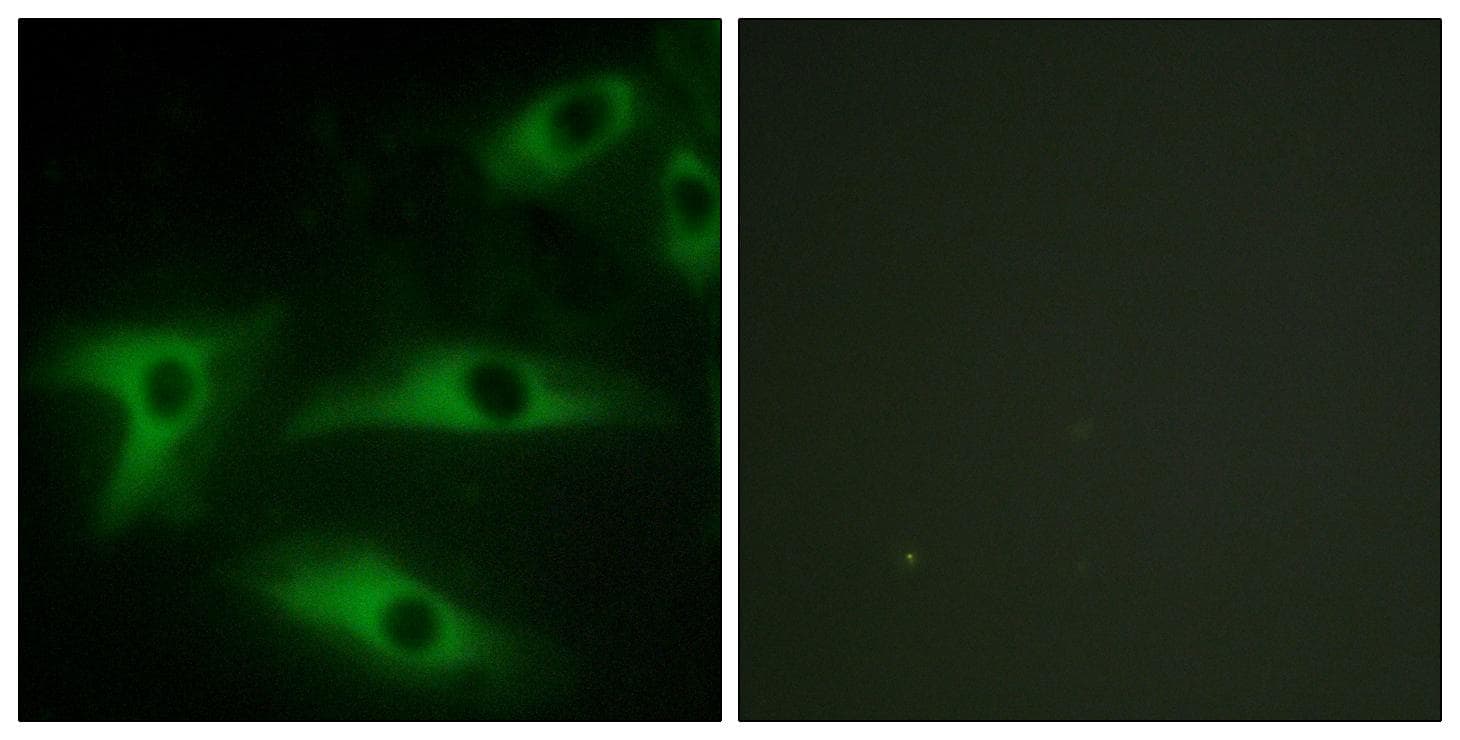 COL1A2 / Collagen I Alpha 2 Antibody