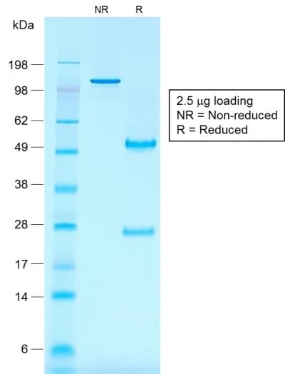 PathPlus™ Recombinant Monoclonal Mouse anti-Human CD30 Antibody (clone rKi-1/779, IHC)