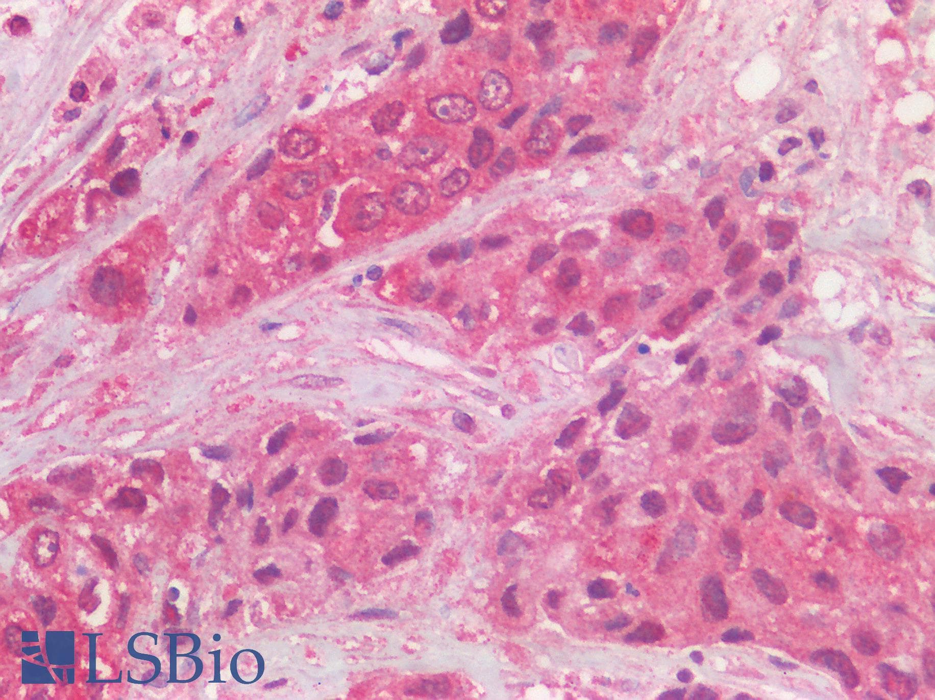 IHC-plus™ EGFR Antibody (C-Terminus)