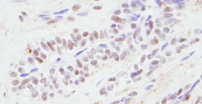 Polyclonal Rabbit anti-Human CREBBP / CREB Binding Protein Antibody (aa2375-2425, IHC, WB)