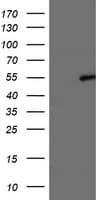 LPL / Lipoprotein Lipase Antibody (aa28-475, clone OTI4H3, Carrier-free)