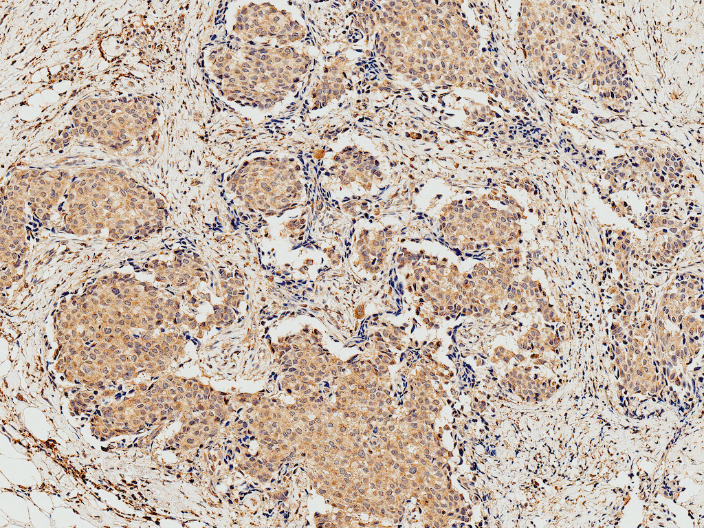 EIF4EBP1 / 4EBP1 Antibody (Biotin)
