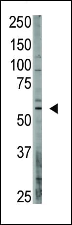 Polyclonal Rabbit anti-Human OASIS / CREB3L1 Antibody (aa491-519, IHC, WB)