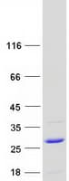 Human UBE2G1 Protein (Recombinant Myc-DDK (Flag))