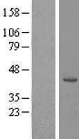 RRS1 Protein (Over-Expression Lysate Myc-DDK (Flag))