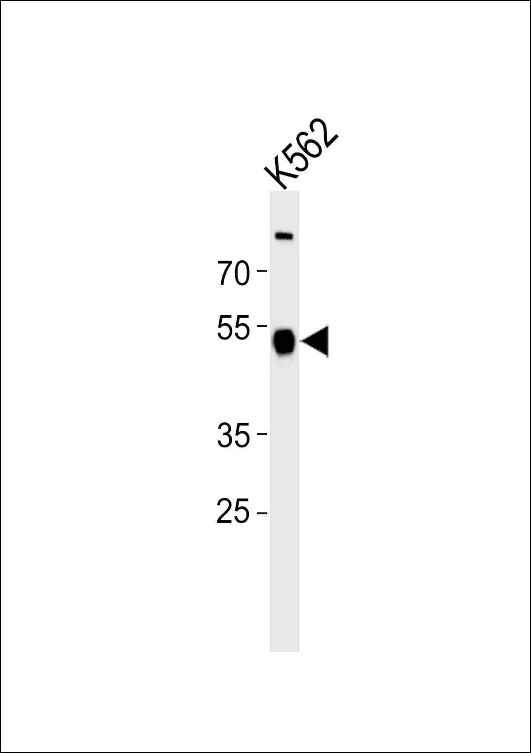 Polyclonal Rabbit anti-Human ZNF500 Antibody (aa28-54, WB)