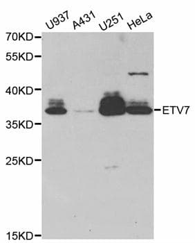 TEL-2 / ETV7 Antibody