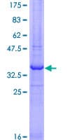 Human RNF121 Protein (Recombinant GST, N-terminus)