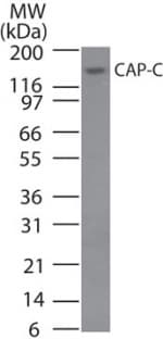 IHC-plus™ Polyclonal Rabbit anti-Human SMC4 Antibody (aa281-297, IHC, WB)
