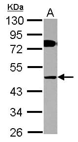 Polyclonal Rabbit anti-Human COLQ Antibody (IHC, WB)