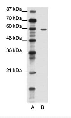 TRIM62 Antibody (N-Terminus)