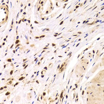 PPP1R8 / Rnase E Antibody