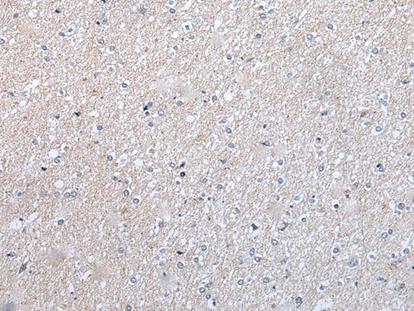 ENPP2 / Autotaxin Antibody