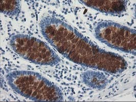 AP50 / AP2M1 Antibody (aa97-383, clone OTI1E9)