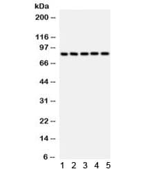 Polyclonal Rabbit anti-Human SOX5 Antibody (WB)