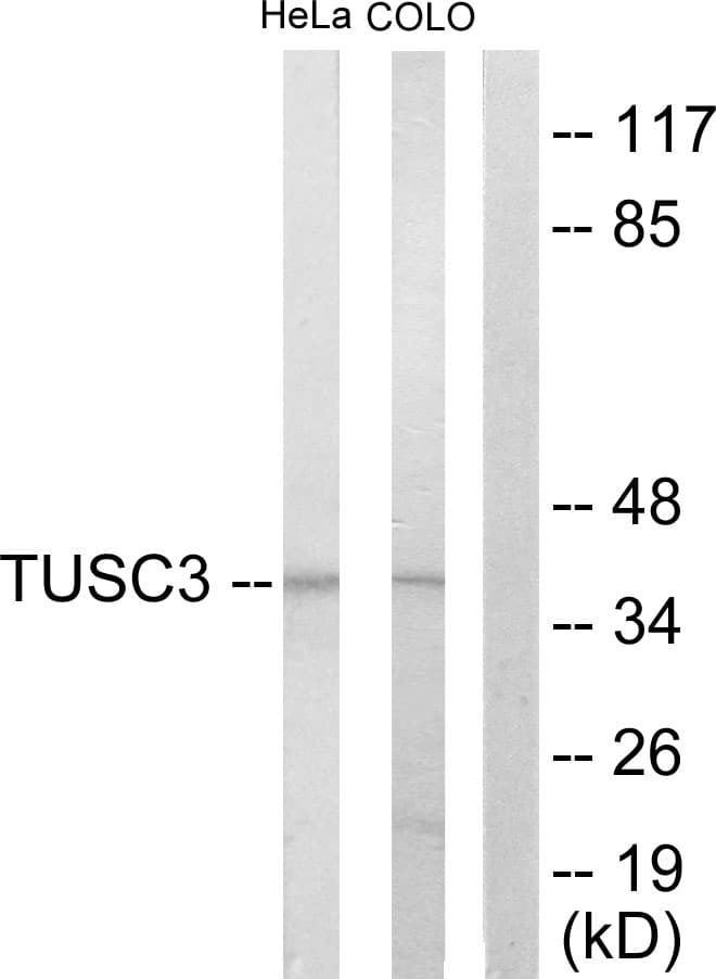 TUSC3 Antibody (aa131-180)