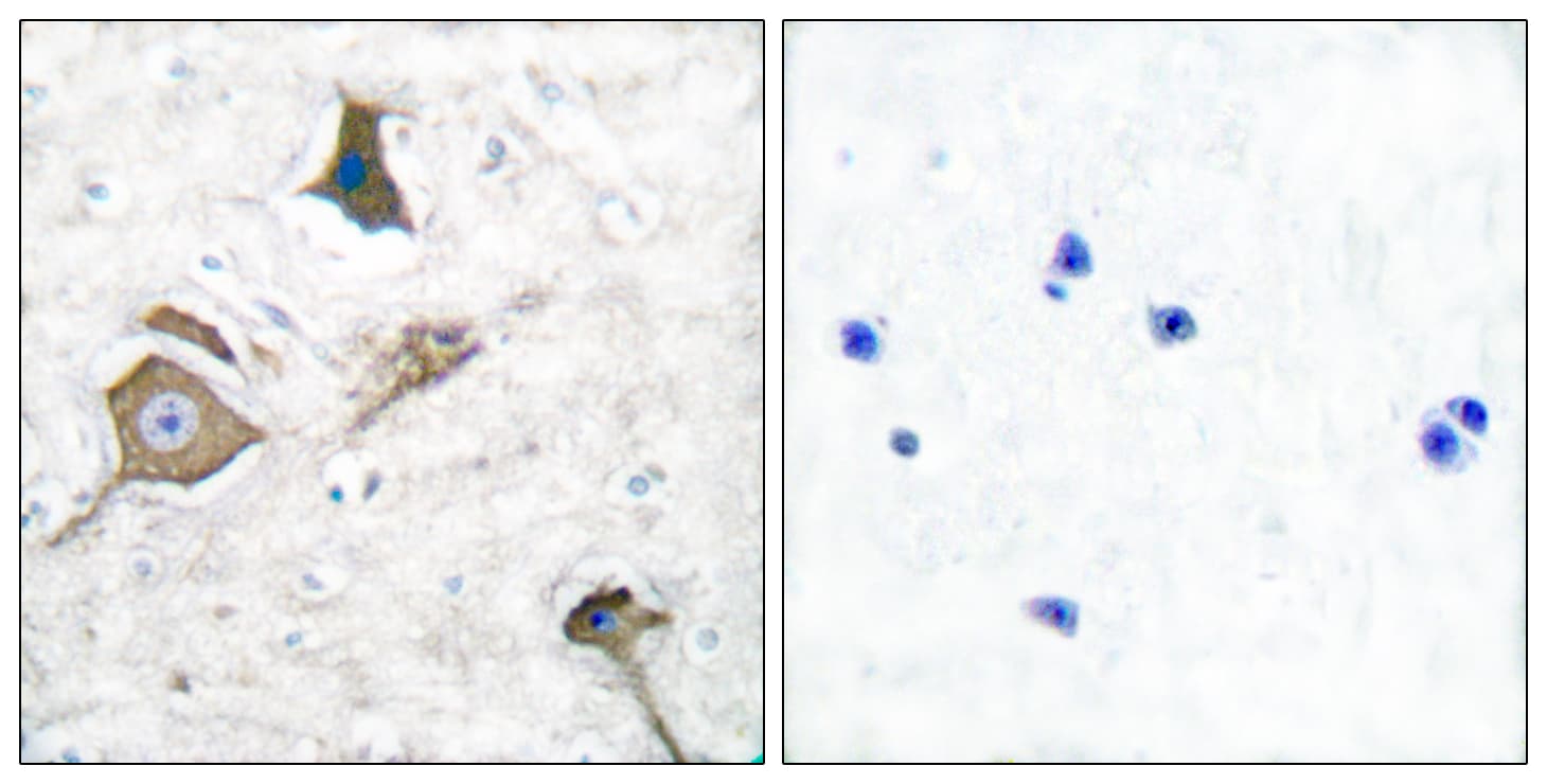Polyclonal Rabbit anti-Human MMP16 Antibody (aa551-600, IHC, WB)