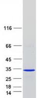 Human RERG Protein (Recombinant Myc-DDK (Flag))