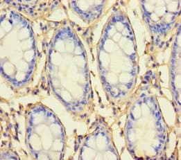 Polyclonal Rabbit anti-Human RHBDL2 / RRP2 Antibody (WB)