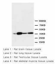 IHC-plus™ ANXA2 / Annexin A2 Antibody (aa121-141)