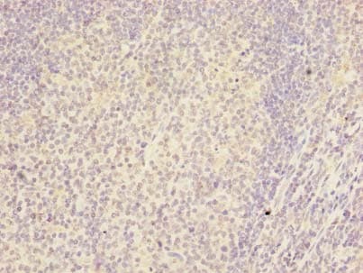 Polyclonal Rabbit anti-Human RSPH14 / RTDR1 Antibody (IHC, WB)