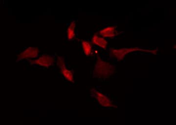 Polyclonal Rabbit anti-Human CAMK2A / CaMKII Alpha Antibody (phospho-Thr305, IHC, IF, WB)