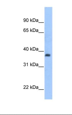 Polyclonal Rabbit anti-Human ST3GAL2 Antibody (C-Terminus, IHC, WB)