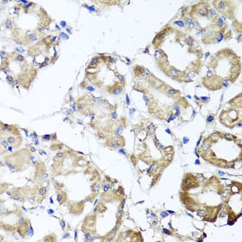 MGAT / GLYT1 Antibody