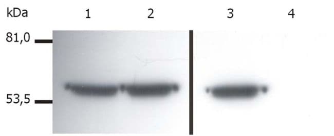 Vimentin Antibody (clone VI-01)