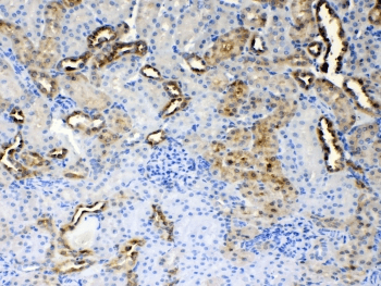 ALDH1A3 Antibody