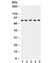 CPT1B Antibody