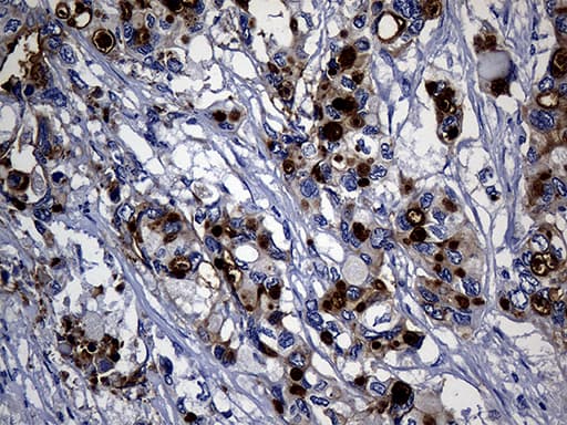 KRT14 / CK14 / Cytokeratin 14 Antibody (aa261-472, clone OTI5F2)