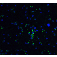 DAXX Antibody