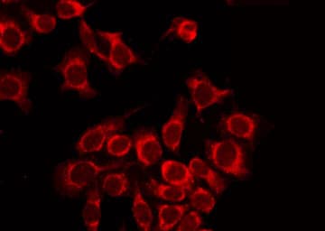 CASR/Calcium Sensing Receptor Antibody (phospho-Thr888)
