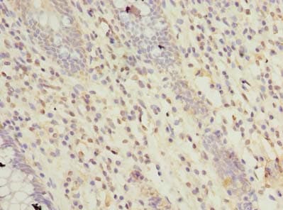 RTP4 / IFRG28 Antibody