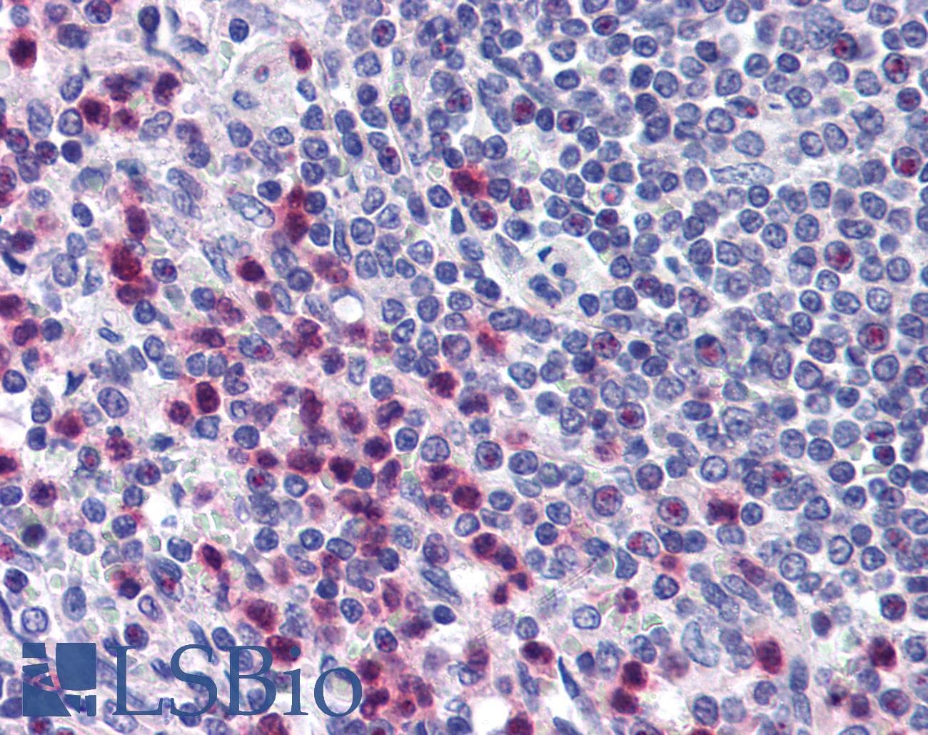 IHC-plus™ STRAP / MAWD Antibody (aa230-280)