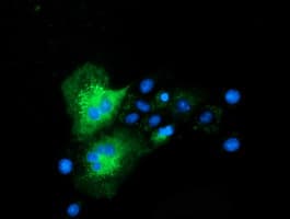 CLPP Antibody (clone OTI1F6, Carrier-free)